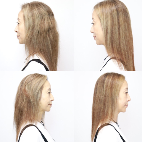 before&after