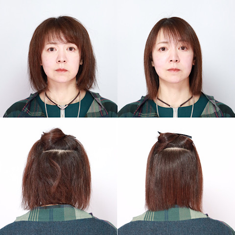 before&after