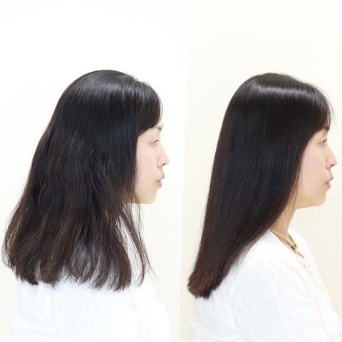 before&after