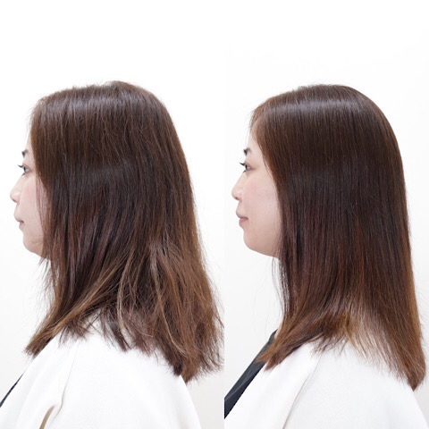 before&after