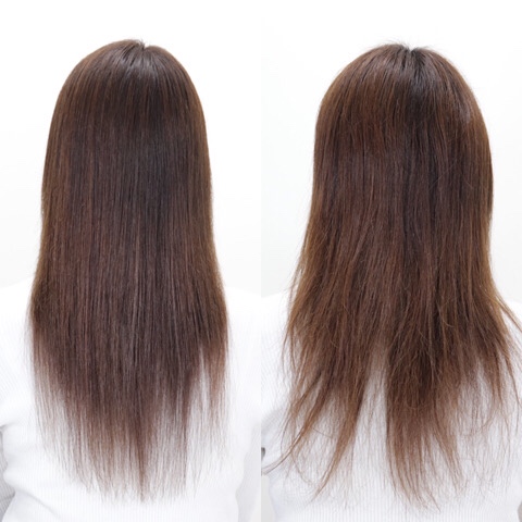 before＆after